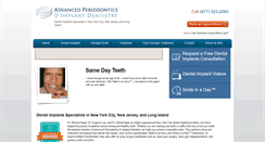 Desktop Screenshot of dentalimplantsusa.com